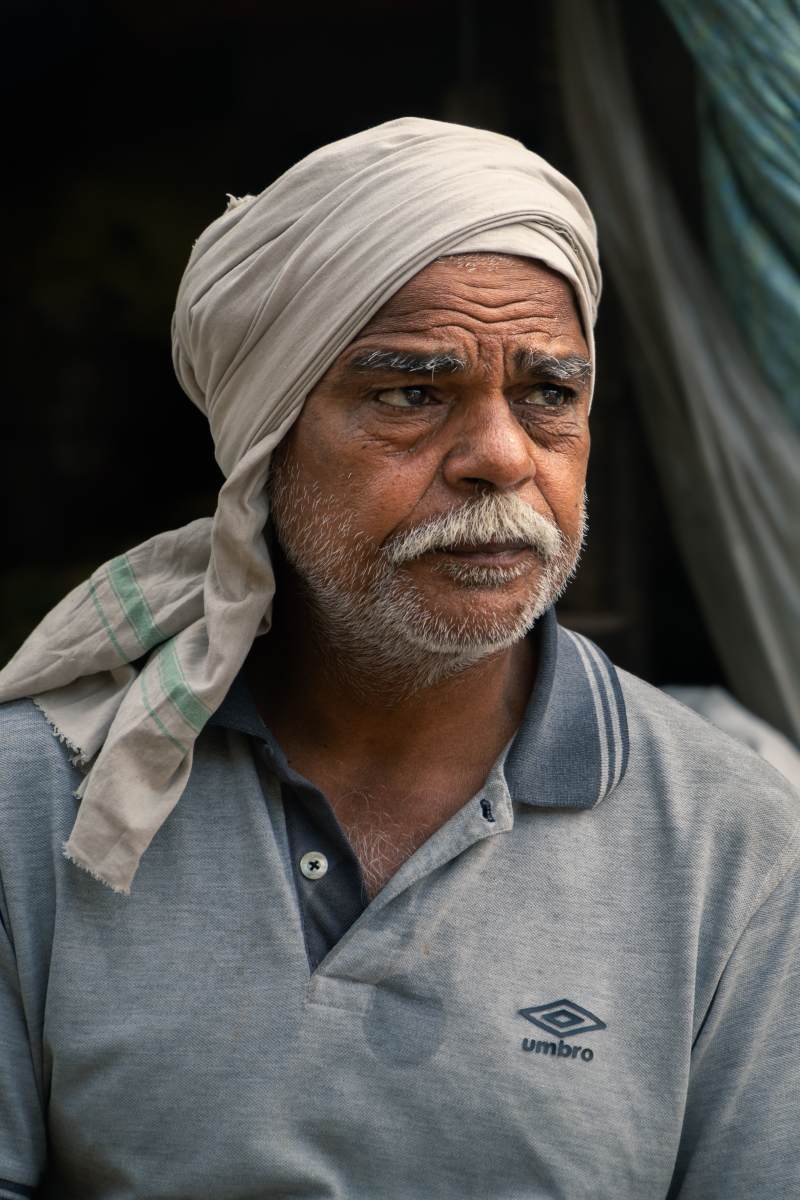 Life's marks on his front head